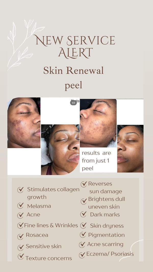 Skin renewal peel