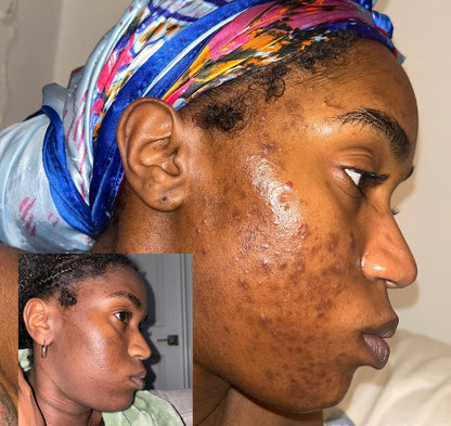 Turmeric Glow Kit